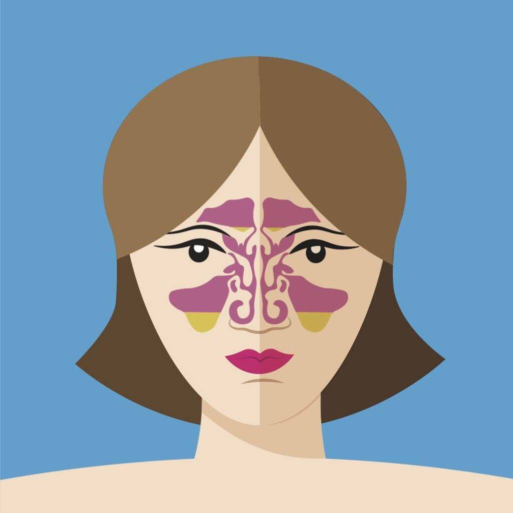 sinusite: rimedi naturalii